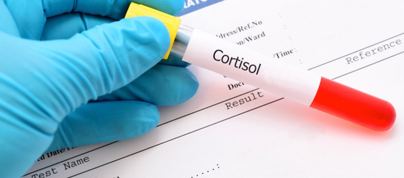 El Cortisol un enemigo